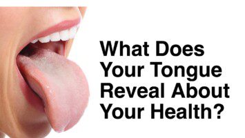 tongue-health