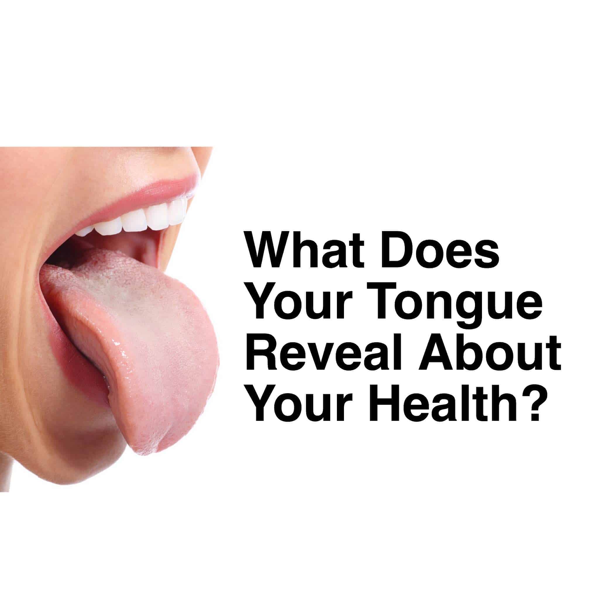 tongue-health