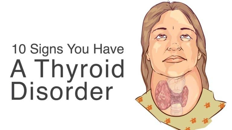 10 Signs You Have A Thyroid Disorder
