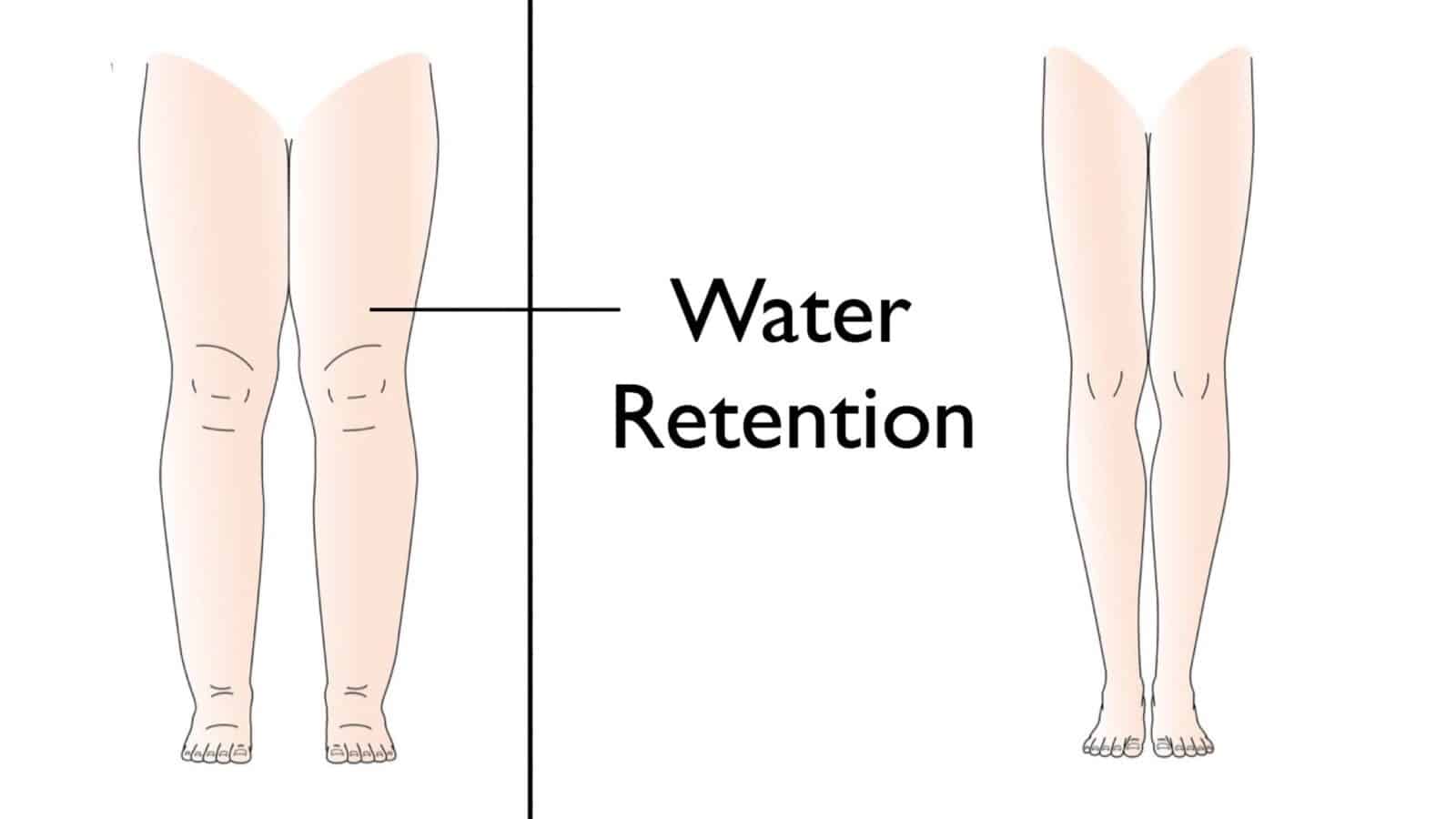 water retention