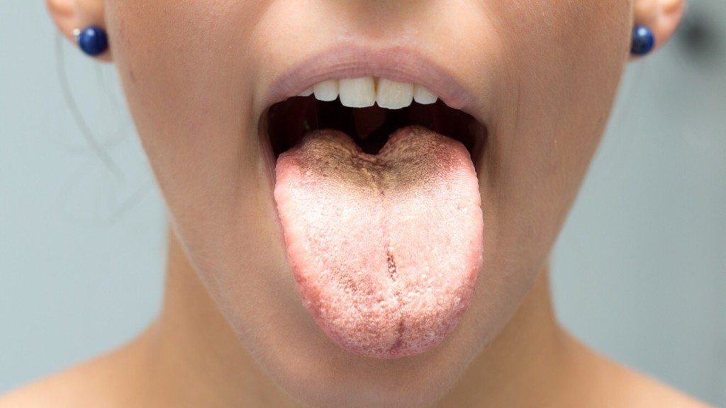 tongue color health