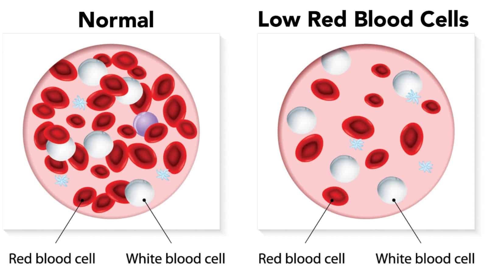 low red blood cell