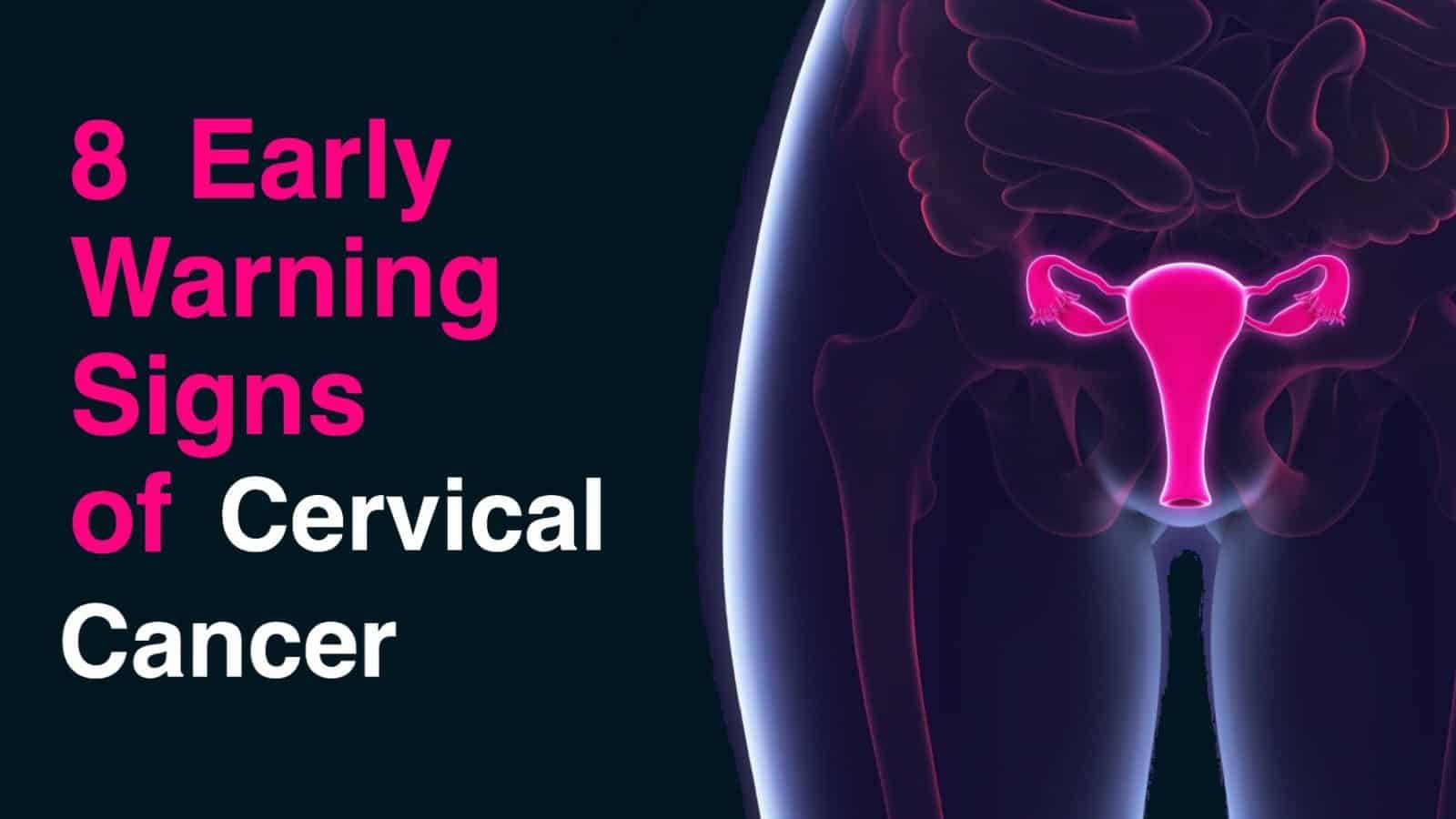 Cervical cancer signs of 10 10 subtle