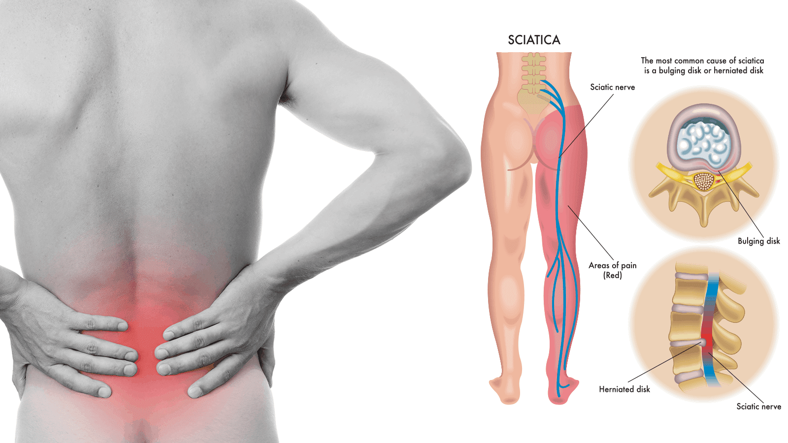 8 sciatica stretches to help prevent and relieve hip and lower back pain