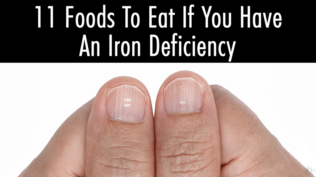 iron deficiency