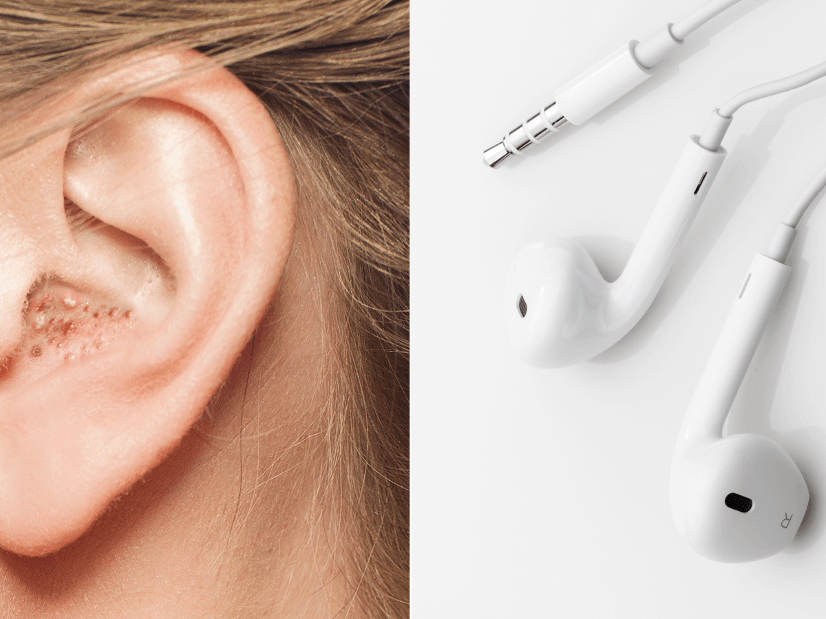 Doctors Warn About What Happens To Your Ears When You Wear Headphones Too Long