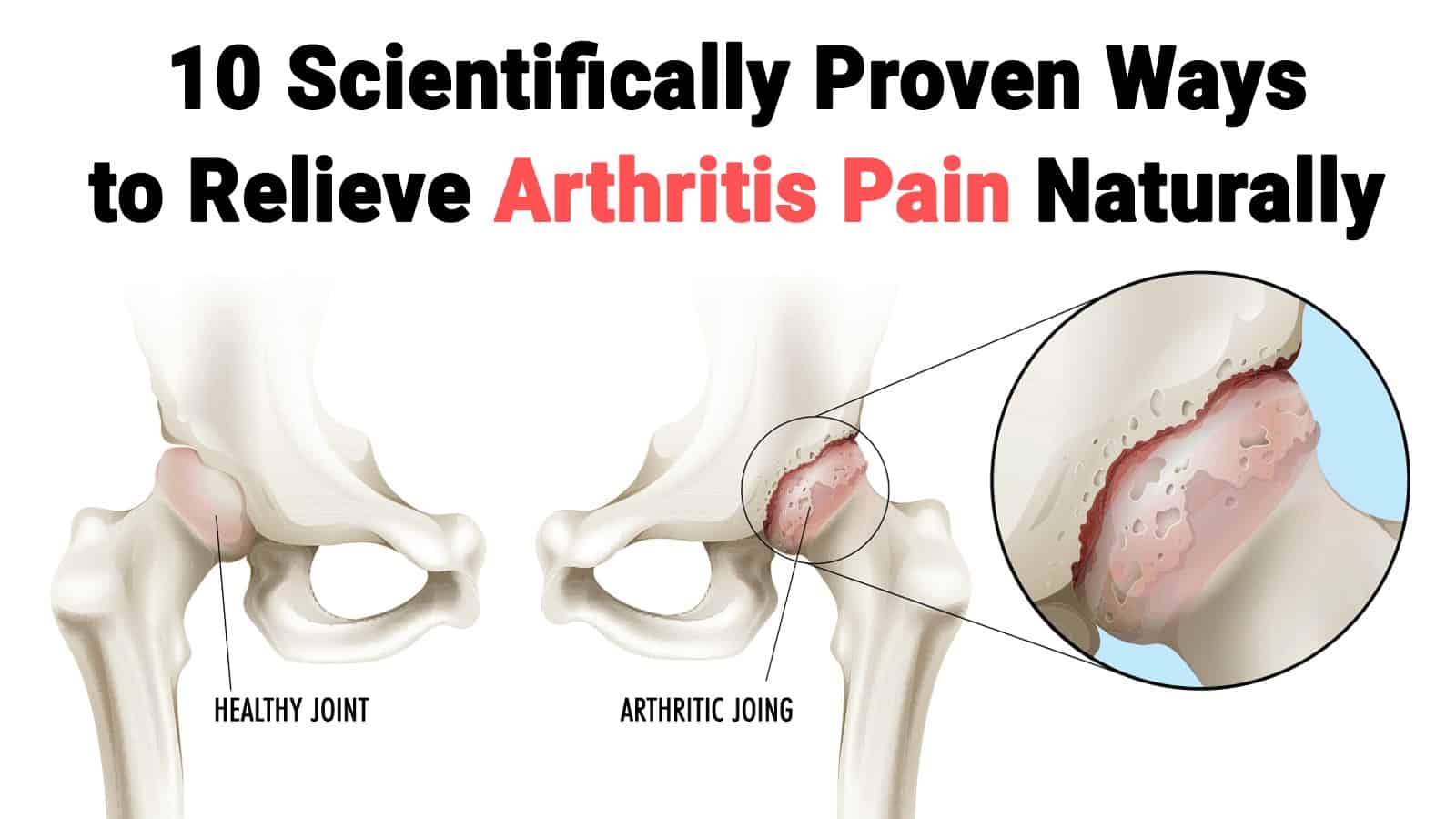 arthritis pain