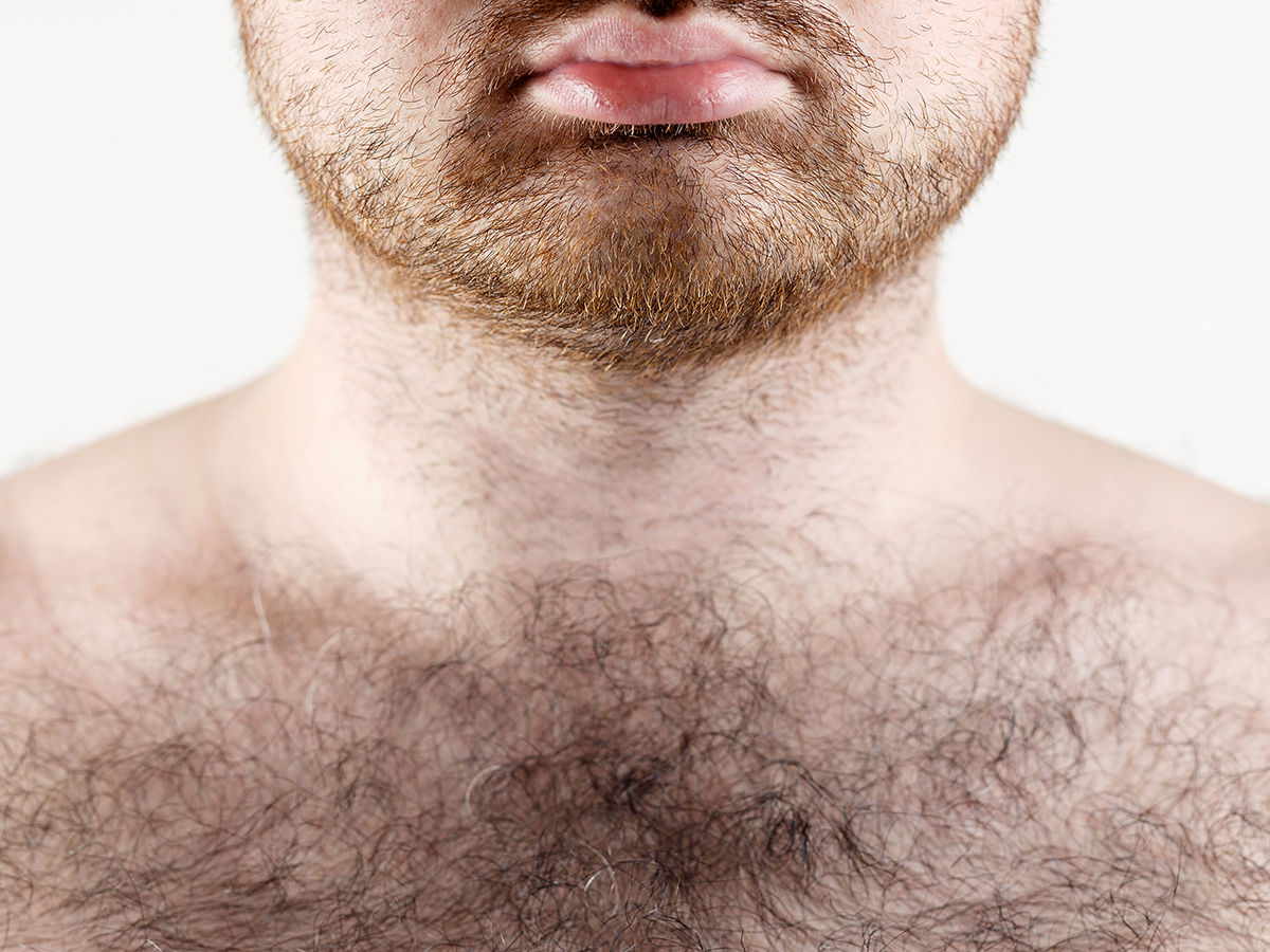 7 Things Your Body Hair Says About Your Health
