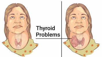 thyroid foods