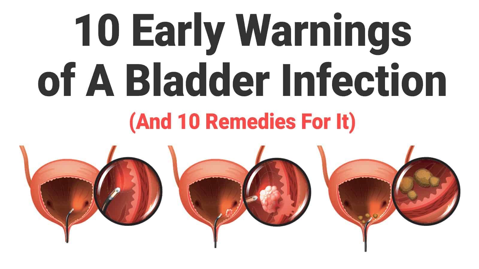 what is a bladder infection