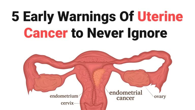 5 Early Warnings Of Uterine Cancer To Never Ignore