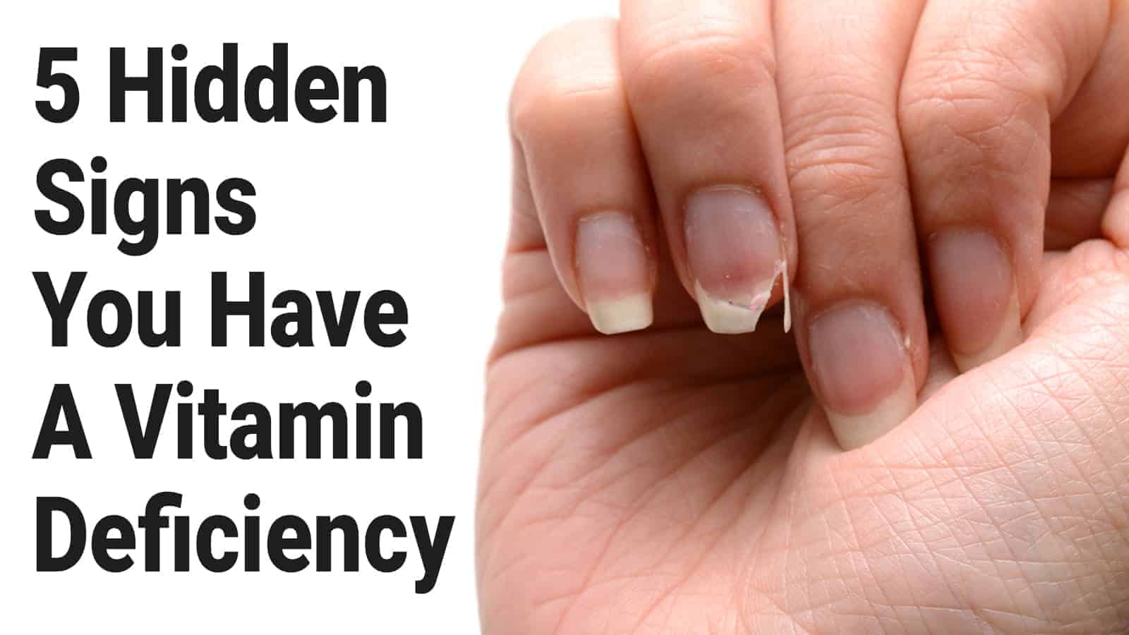 5 Hidden Signs You Have A Vitamin Deficiency »