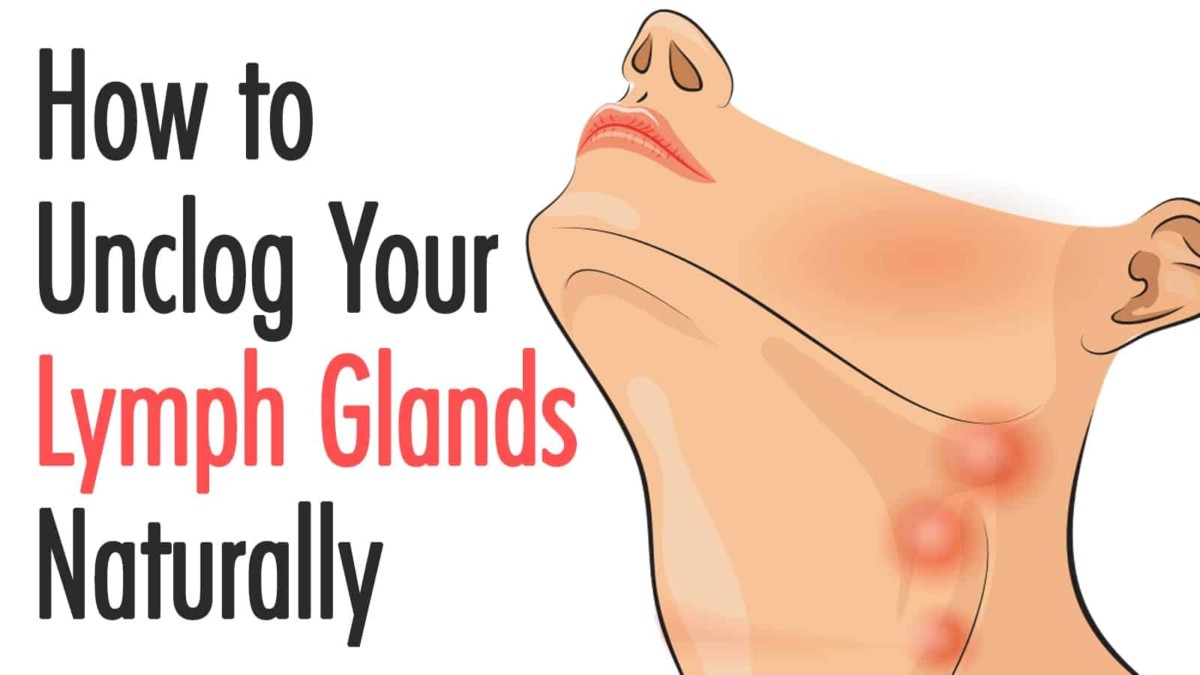 Swollen remedies lymph nodes for 32 Great