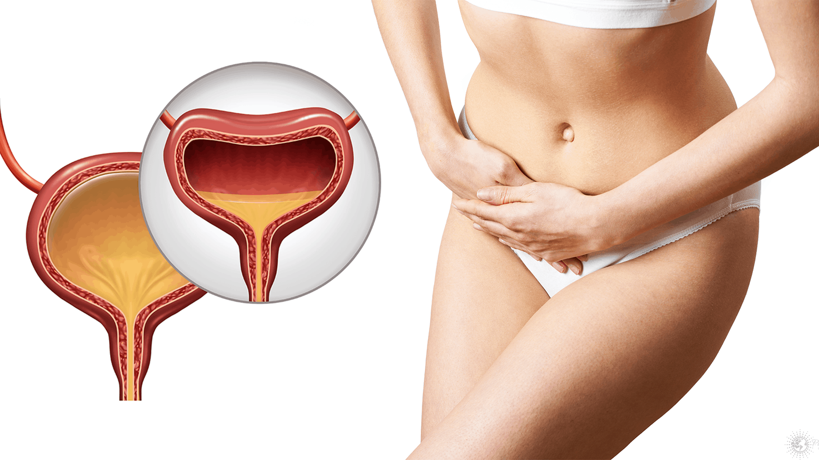 symptoms of a bladder infection