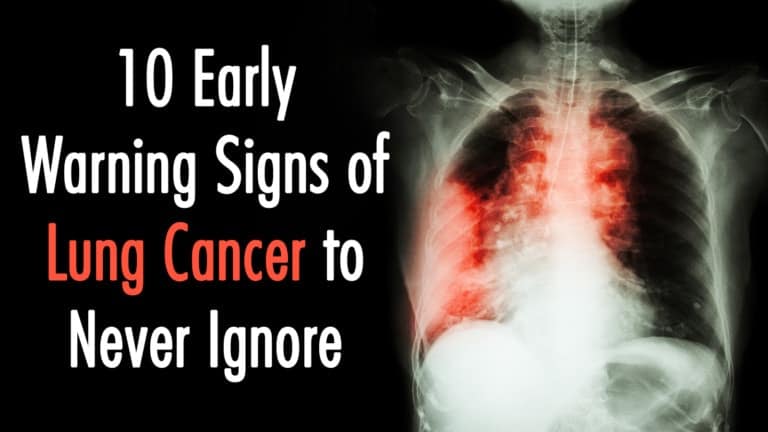lung cancer signs