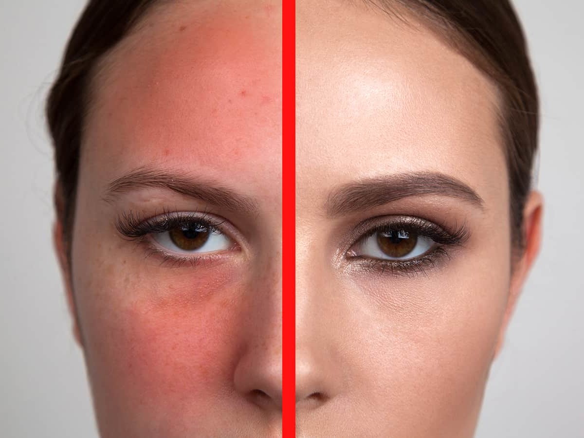 On reduce overnight redness face A Dermatologist