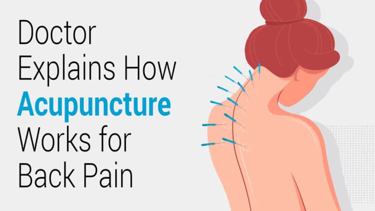 back-pain-acupuncture