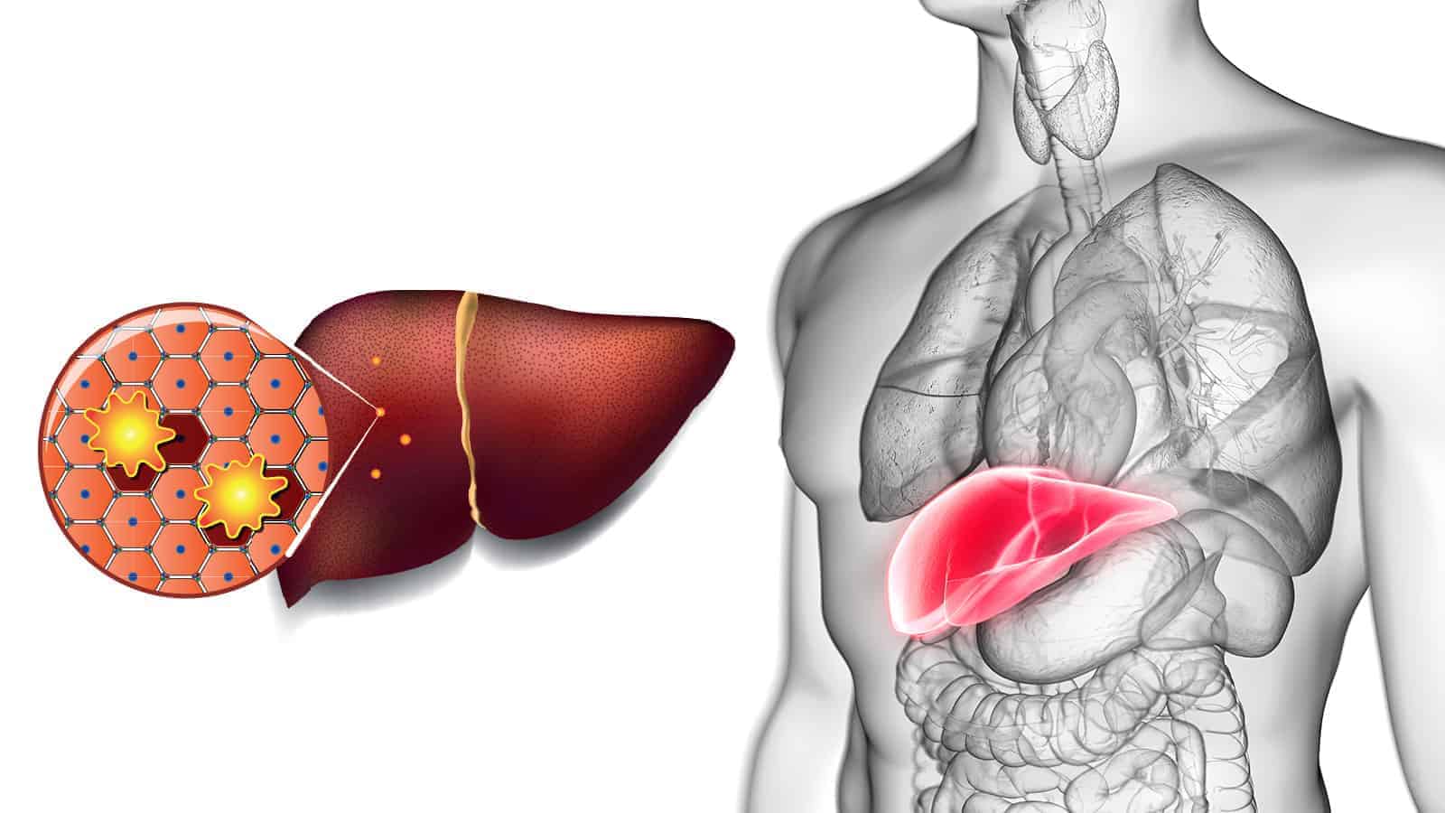 detoxing your liver