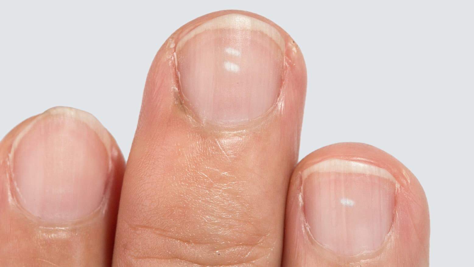 olive oil for nails health