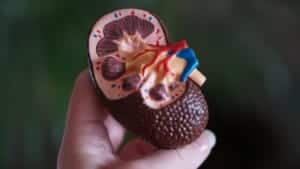 model of a kidney