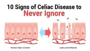 celiac symptoms