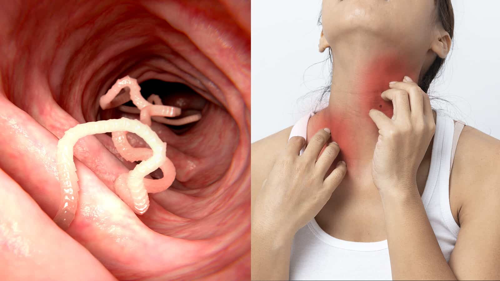 15 Signs of a Parasitic Infection Never to Ignore | 7 Minute Read
