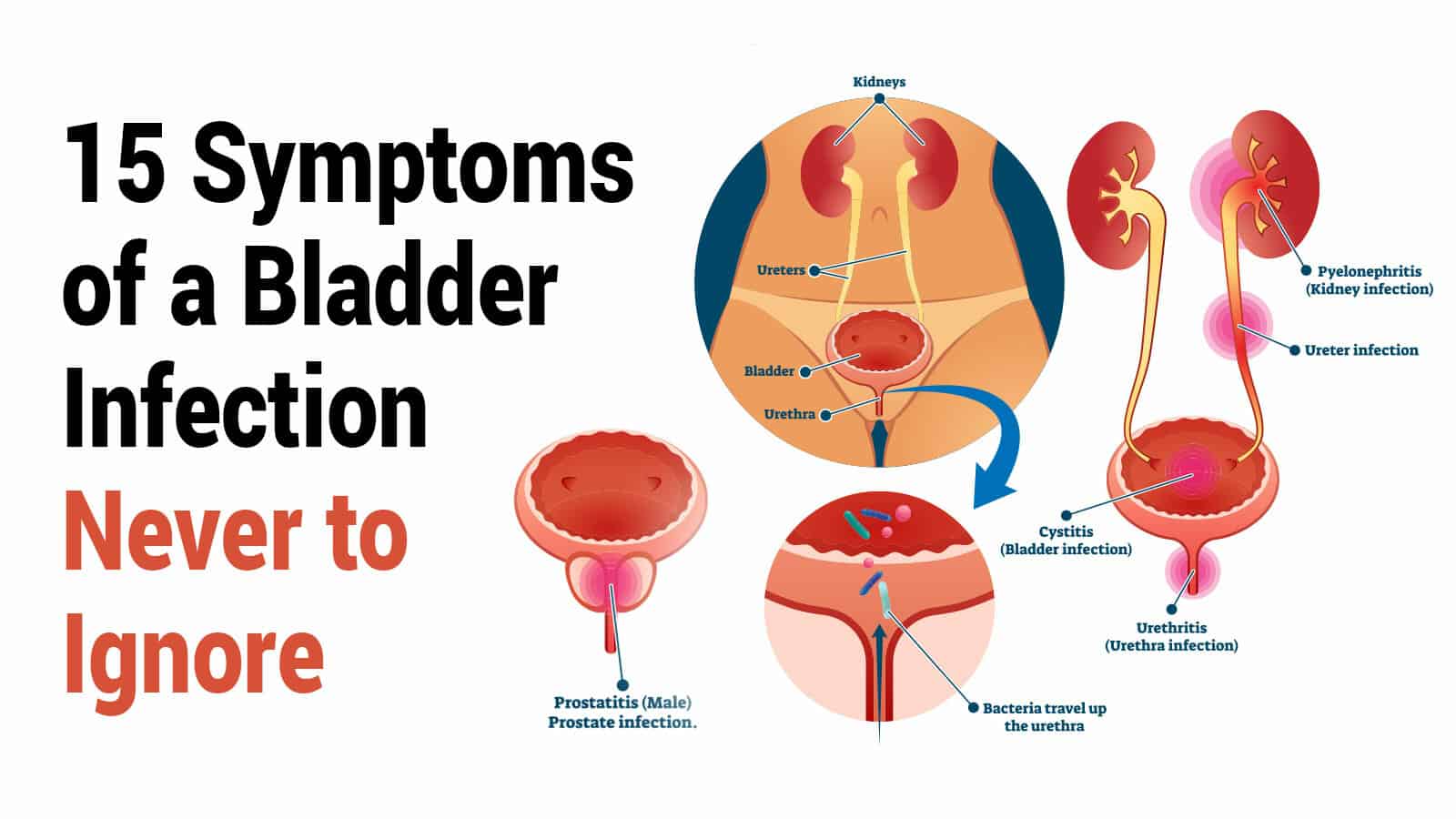 bladder infection signs