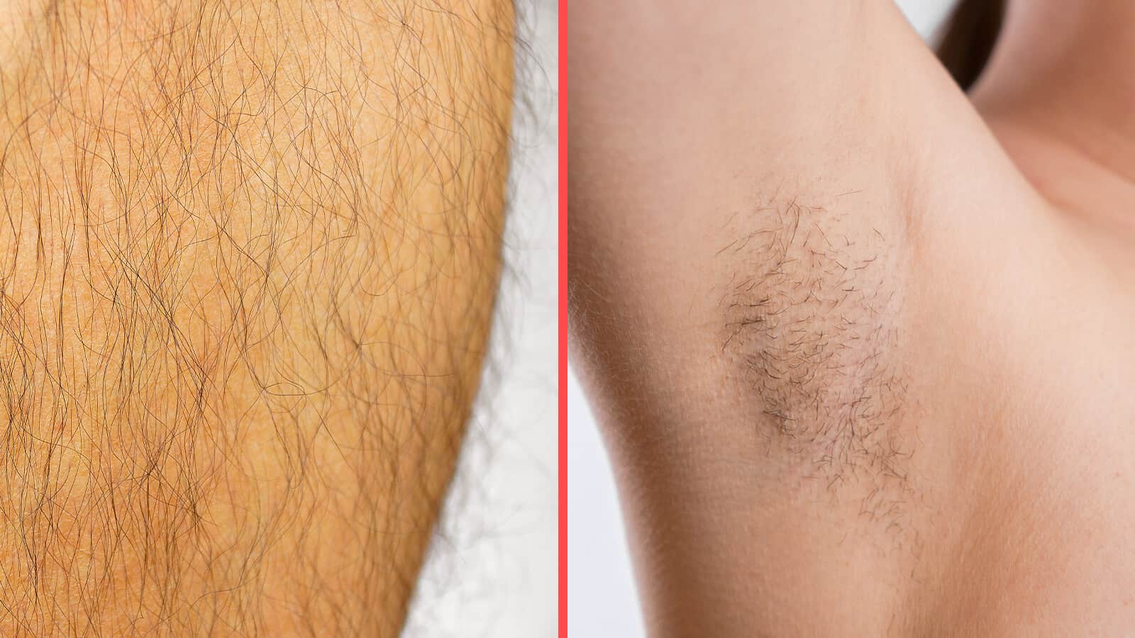 4 Things You Can Learn About Your Health Through Your Body Hair