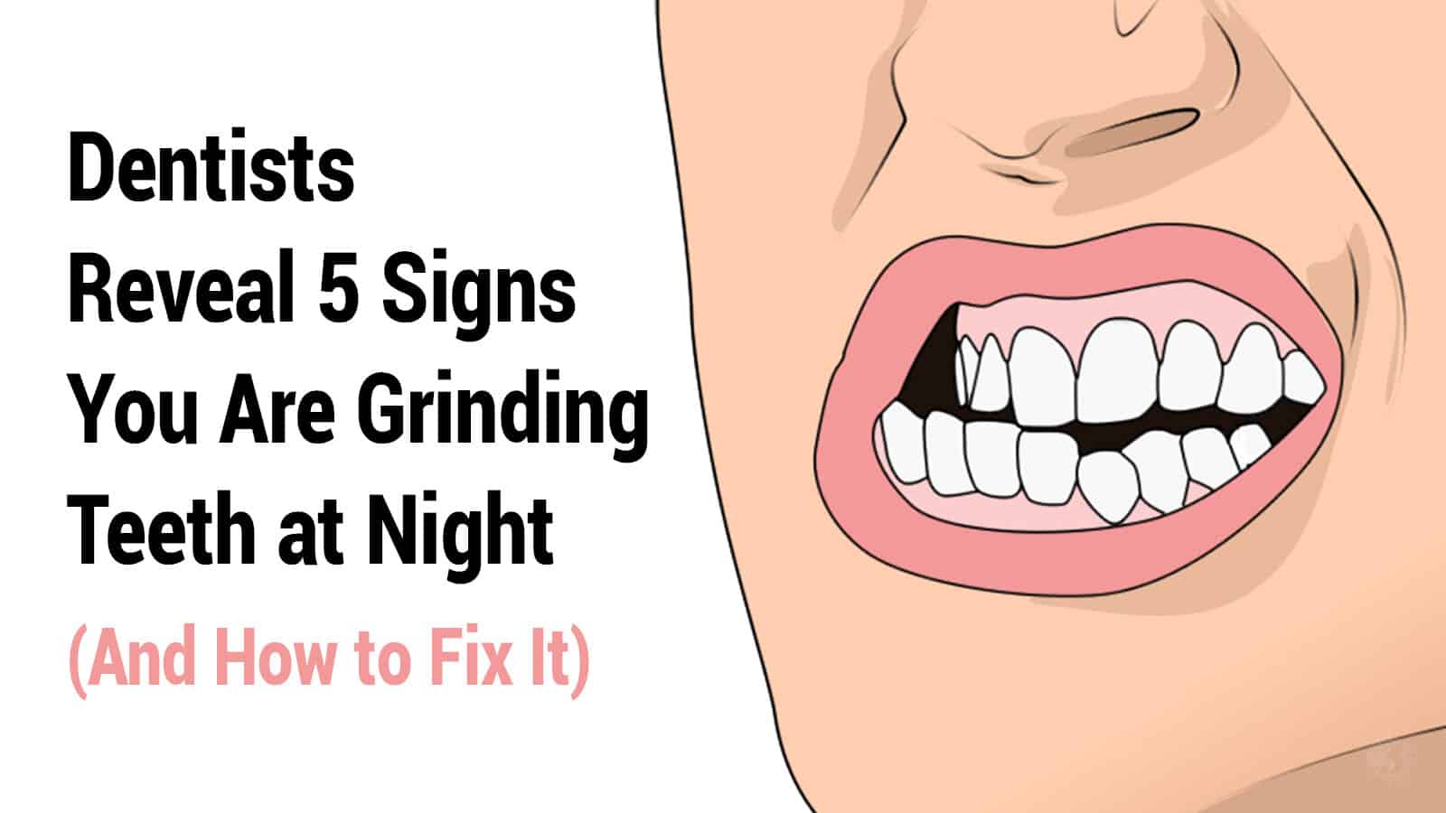 grinding teeth