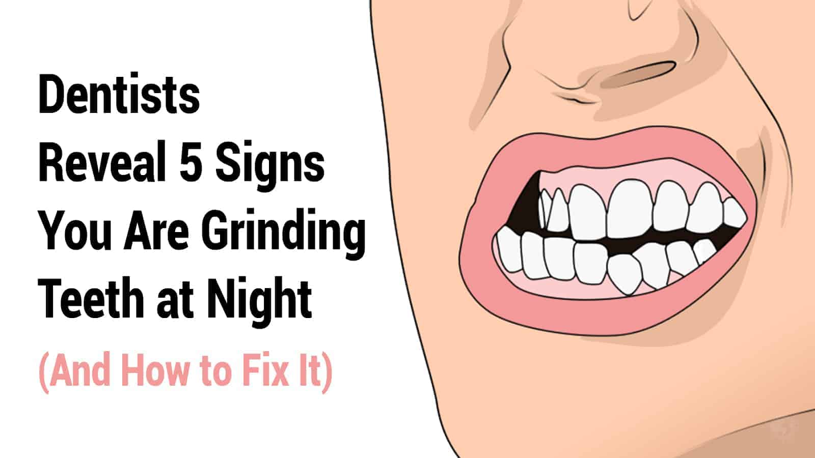 grinding teeth
