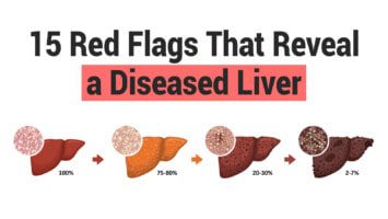 diseased liver