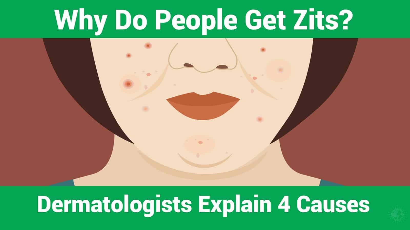 Why Do People Get Zits? Dermatologists Explain 4 Causes