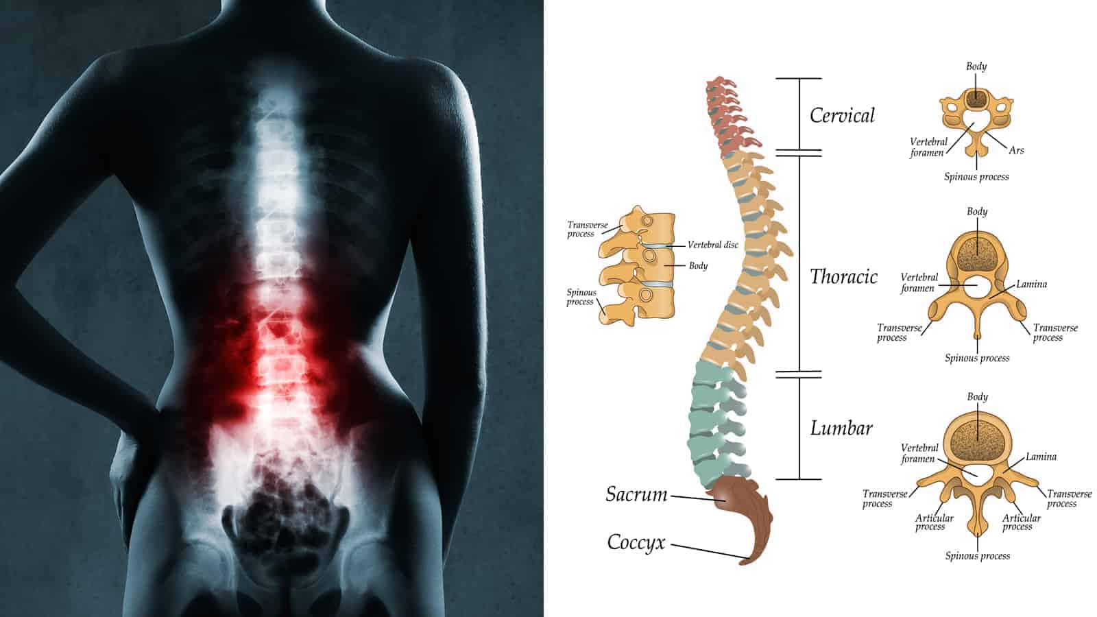 10 Daily Habits That Help Make Your Spine Healthier