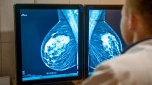mammogram for persistent breast pain