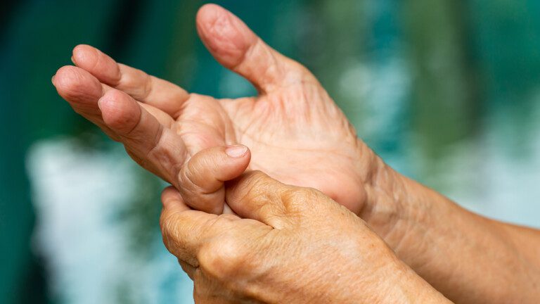 arthritis in fingers